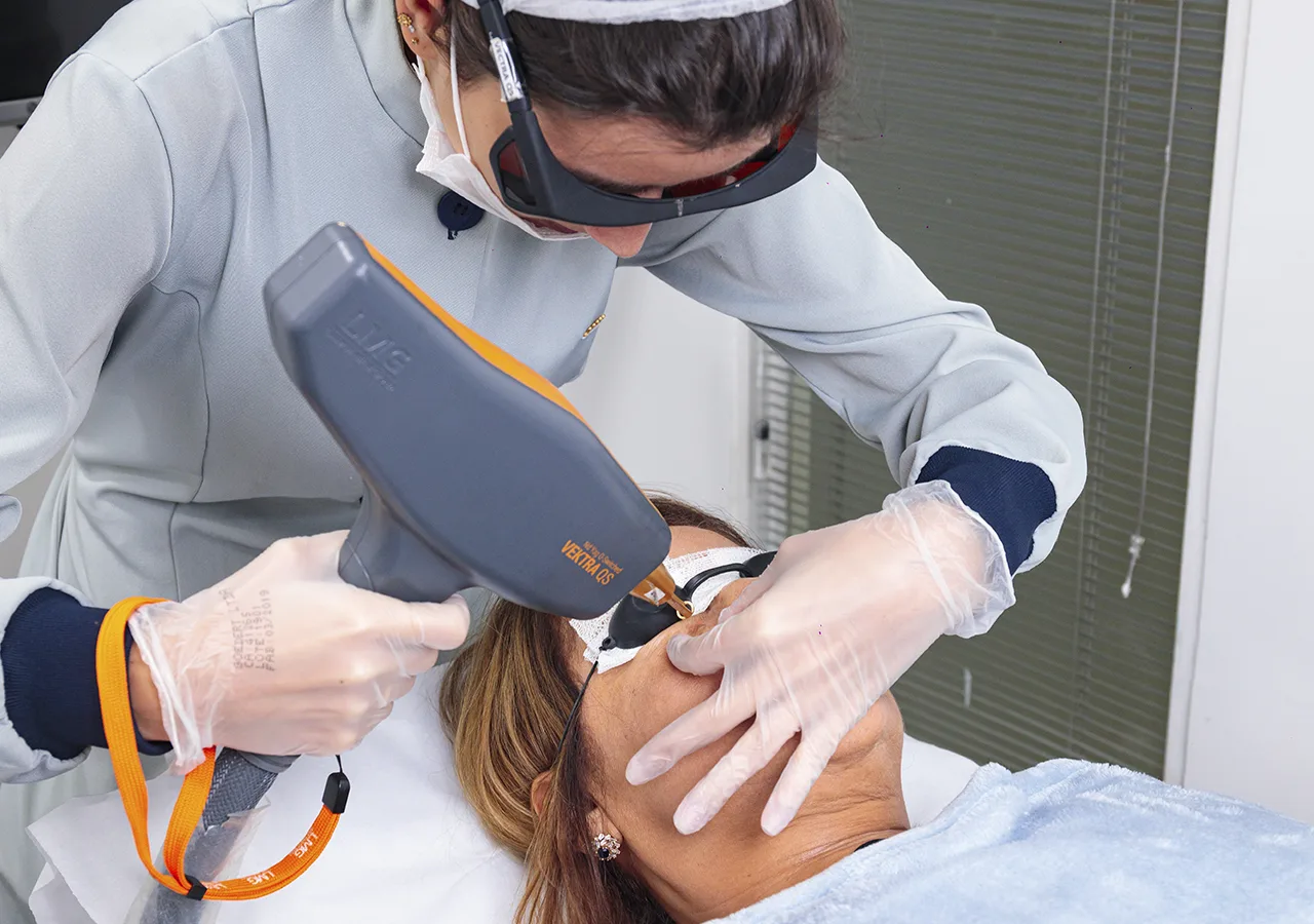 Laser para Olheiras 